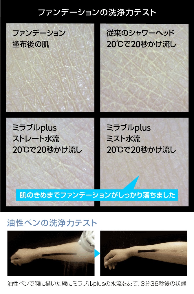 ミラブルはニキビに効果があるの 肌荒れ改善できる理由は何